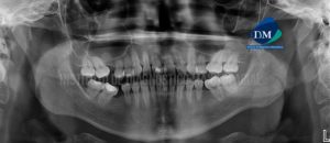 IDM - Radiografía - idm