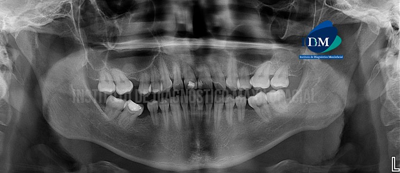 IDM - Radiografía - idm