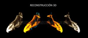 IDM - Reconstrucción 3D - idm