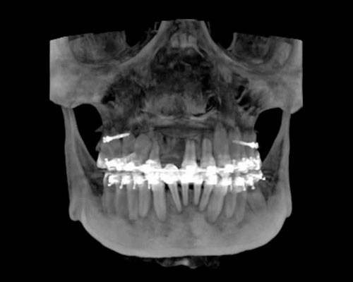 08-6b2d318340