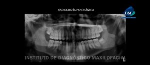 IDM - Radiografía panorámica - idm