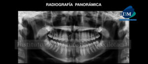 IDM - Radiografía Panorámica - idm