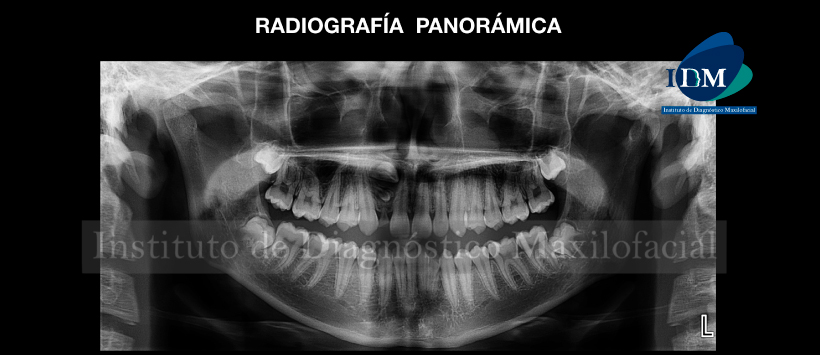 IDM - Radiografía Panorámica - idm