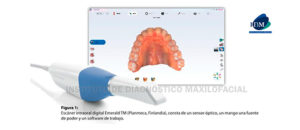 IDM perú - Escáner intraoral digital - Plamenca - Finlandia - IDM - Consta de un sensor óptico, un mango una fuente de poder y un software de trabajo