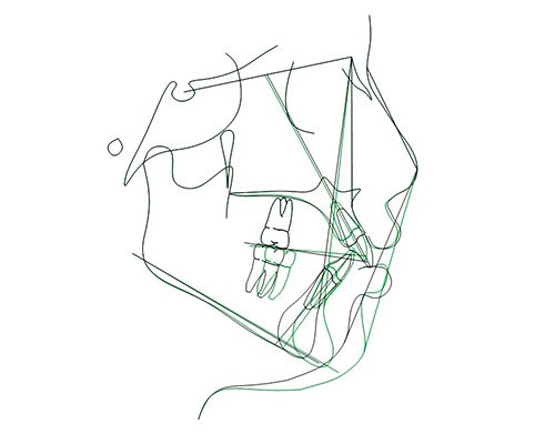 10-dd118aa424