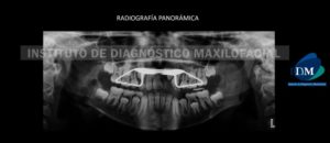 IDM - Radiografía panorámica - idm