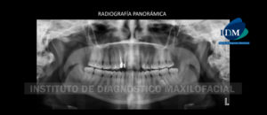 IDM - Radiografía Panorámica - idm