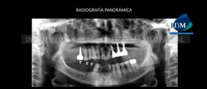 IDM - Radiografía Panorámica - idm