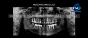 IDM - Radiografía Panorámica - idm