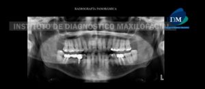 IDM - Radiografía Panorámica - idm
