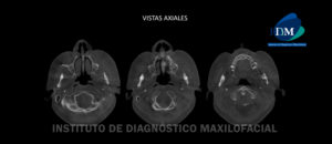 IDM - Vistas Axiales - idm