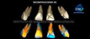 IDM - Reconstrucción 3D - idm