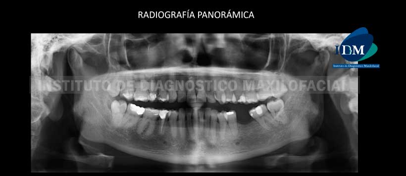 IDM - Radiografia Panorámica - idm