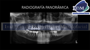 banner radiografía panorámica IDM IDMPERU