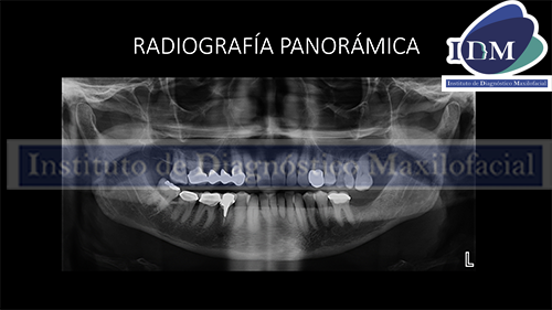 banner radiografía panorámica IDM IDMPERU