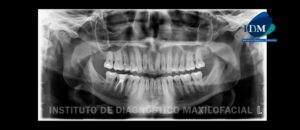 IDM Radiografía