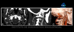 IDM FIGURAS a b c
