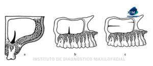 IDM FIGURAS a b c