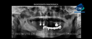 IDM - Radiografía Panorámica - idm