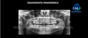 IDM - Radiografía Panorámica - idm