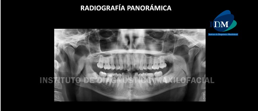 IDM - Radiografía Panorámica - idm
