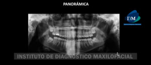 IDM - Panoramica - idm