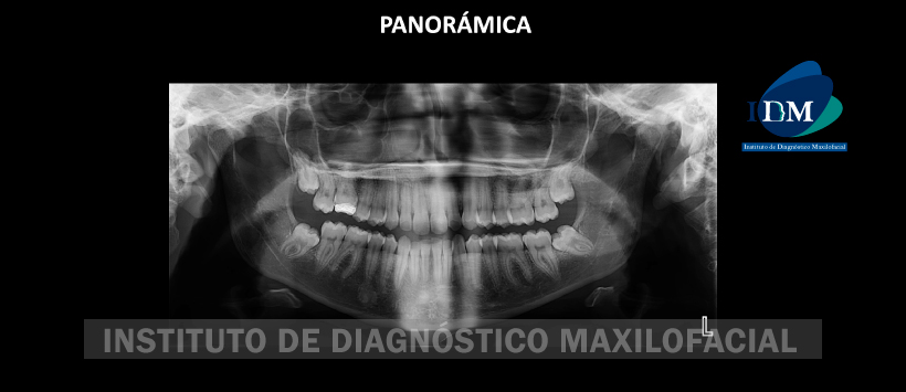 IDM - Panoramica - idm