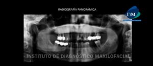 IDM - Radiografía panorámica - idm