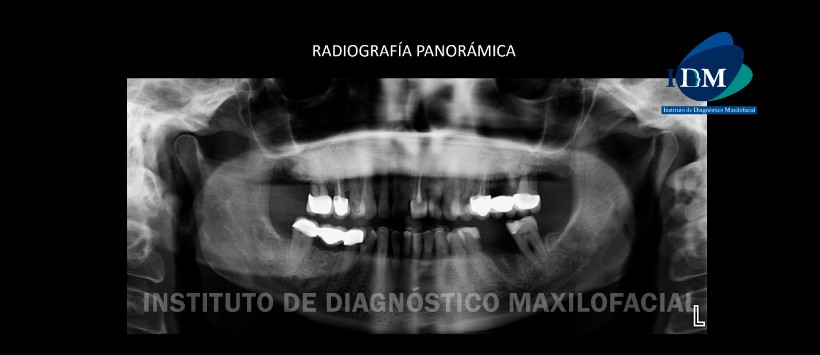 IDM - Radiografía panorámica - idm