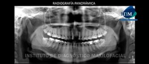 IDM - Radiografía Panorámica - idm