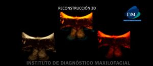 IDM - Reconstrucción 3D - idm