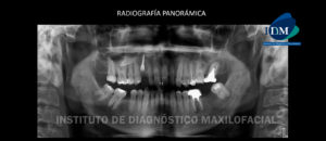 IDM - Radiografía Panorámica - idm