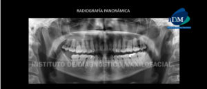 IDM - Radriografia Panorámica - idm