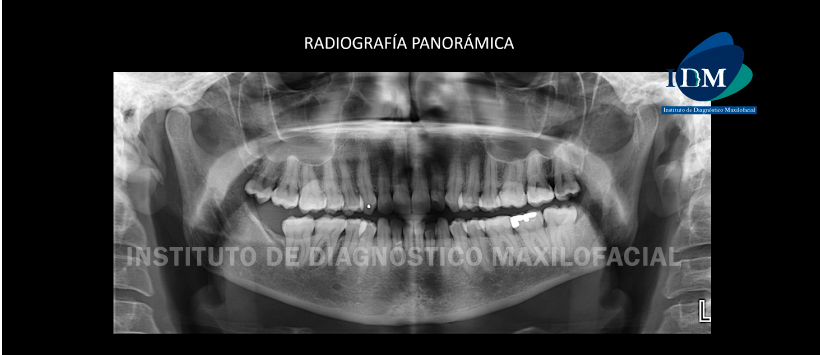 IDM - Radriografia Panorámica - idm