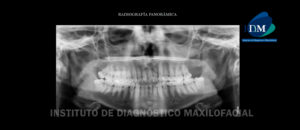 IDM - Radiografía Panorámica - idm