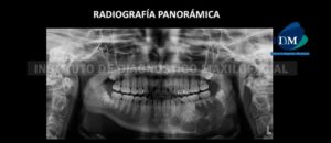 IDM - Radiografía Panorámica - idm