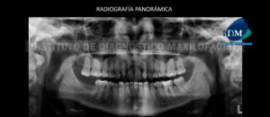 IDM - Radiografía Panorámica - idm