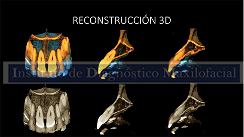 RECONSTRUCCIÓN 3D IDM IDMPERU