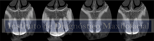 radiografía IDM IDMPERU