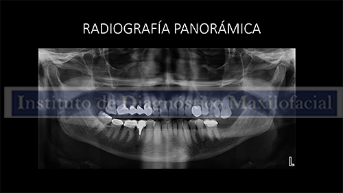 radiografía panorámica IDM IDMPERU