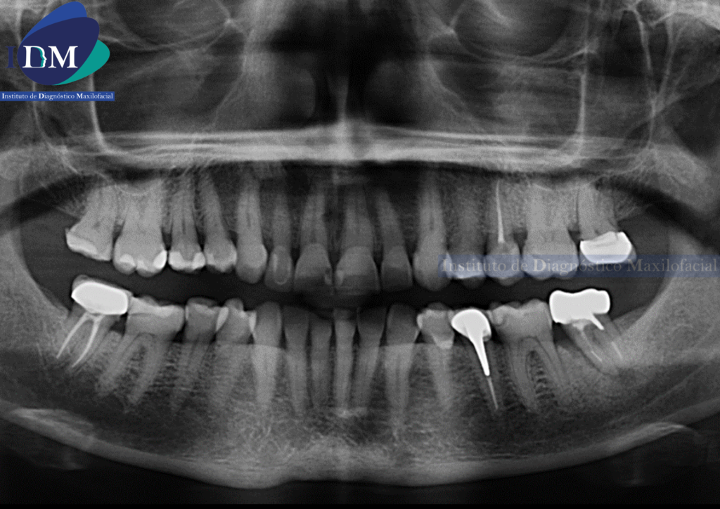 RADIOGRAFIA PANORAMICA IDM IDMPERU