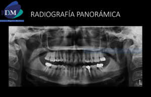 RADIOGRAFIA PANORAMICA IDM IDMPERU