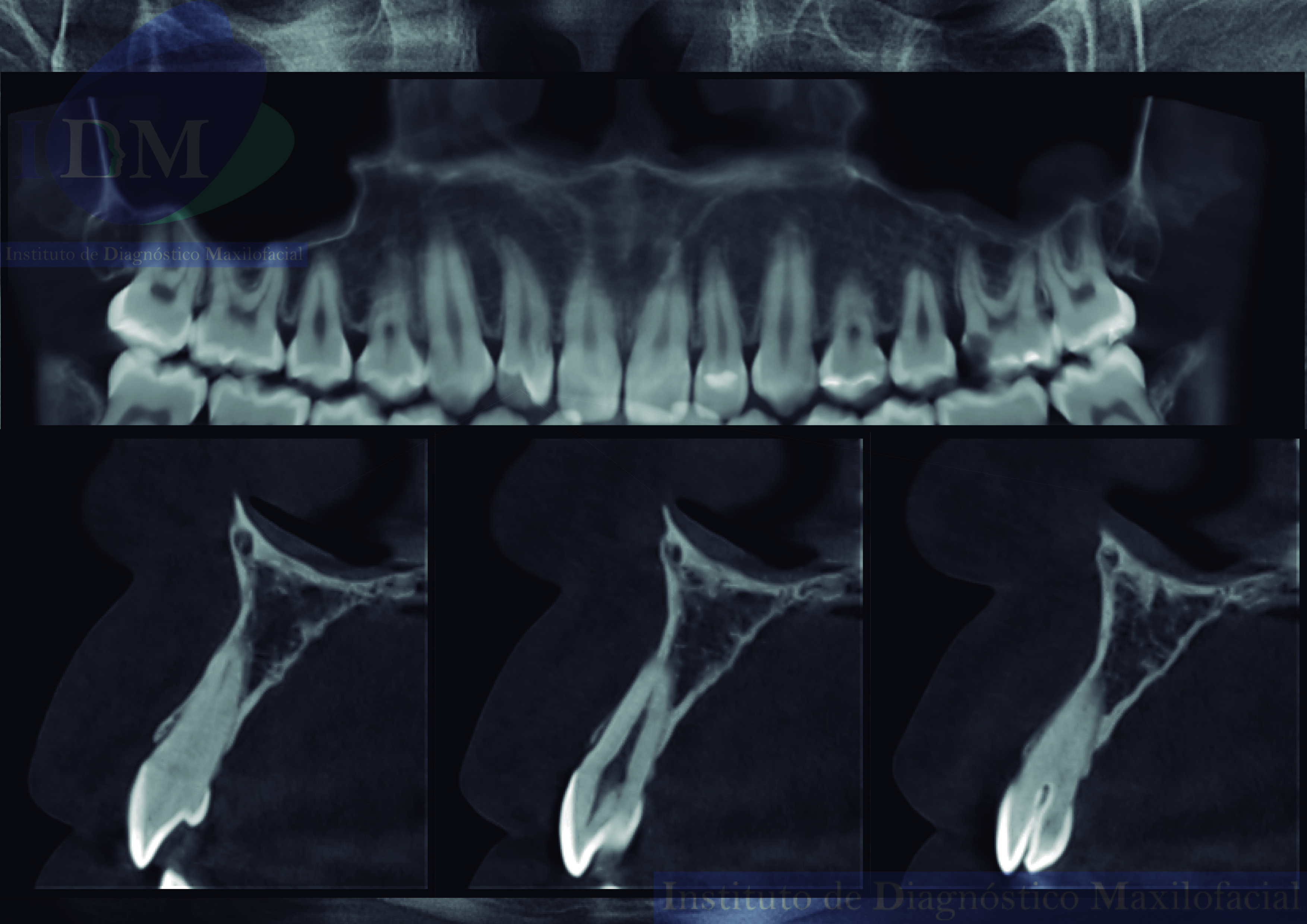 Imagen de caso de estudio de cortes tangenciales, una herramienta esencial para el diagnóstico odontológico. Vista panorámica IDM de alta resolución para análisis dental detallado. IDM Peru, expertos en tecnología dental, ofrecen soluciones avanzadas para la atención odontológica. IDM Peru Caso 263 Cortes tangenciales Vista Panorámica IDM Diagnóstico odontológico Análisis dental Odontología Tecnología dental Atención odontológica Anatomía dental