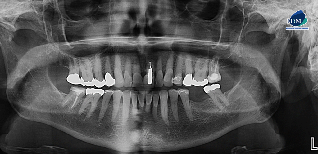 IDM CASO 273 PANORAMICA IDM