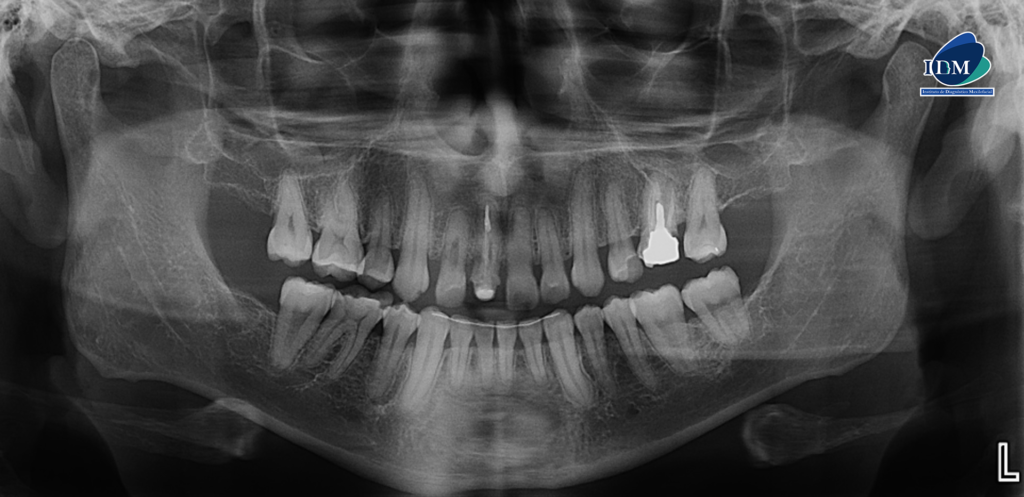 IDM-CASO-280-PANORAMICA IDM