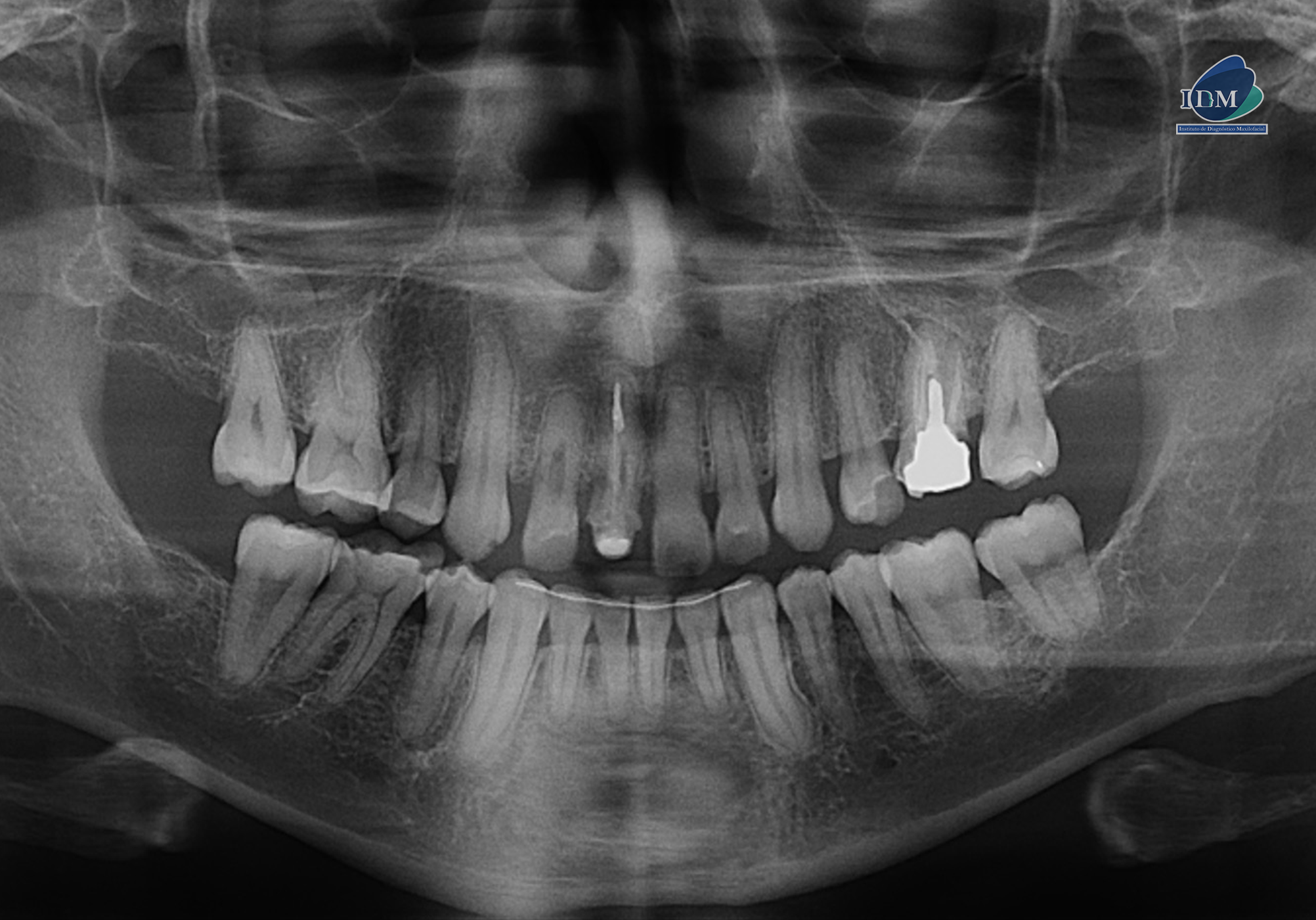 IDM-CASO-280-PANORAMICA IDM 2