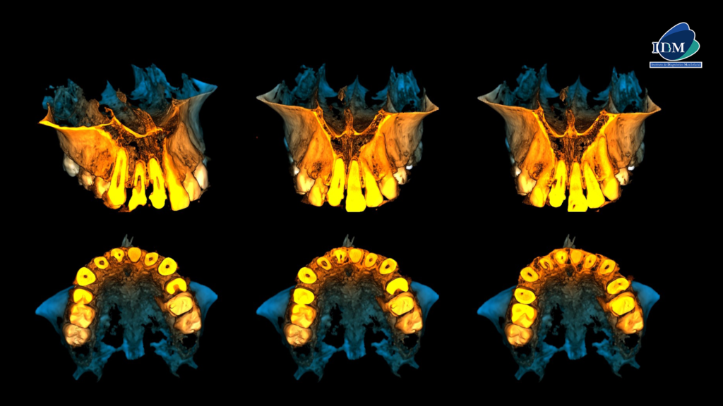 IDM-CASO-280-RECONSTRUCCIONES-3D IDM