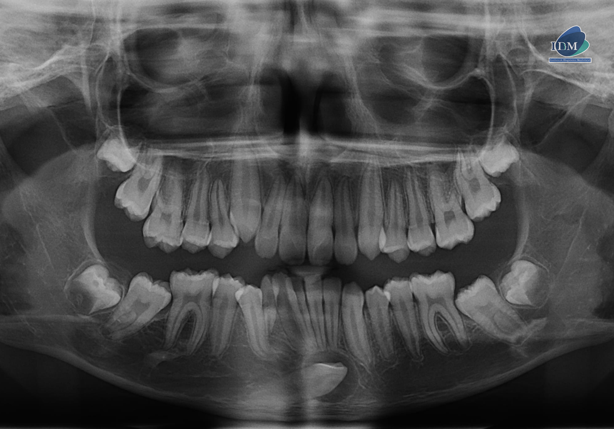 IDM-CASO-281-PANORAMICA 2 IDM