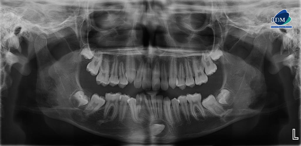 IDM-CASO-281-PANORAMICA IDM