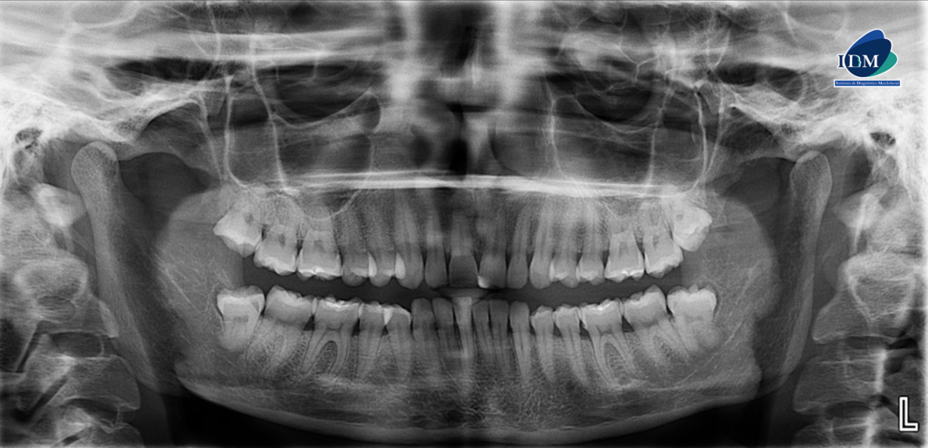 IDM CASO 284 PANORAMICA 1 IDM